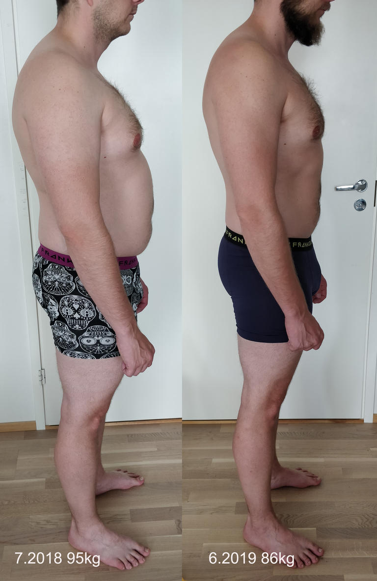 Ville: Kymmenen kiloa pysyvästi pois intuitiivisella otteella